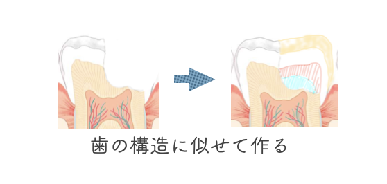ダイレクトボンディング