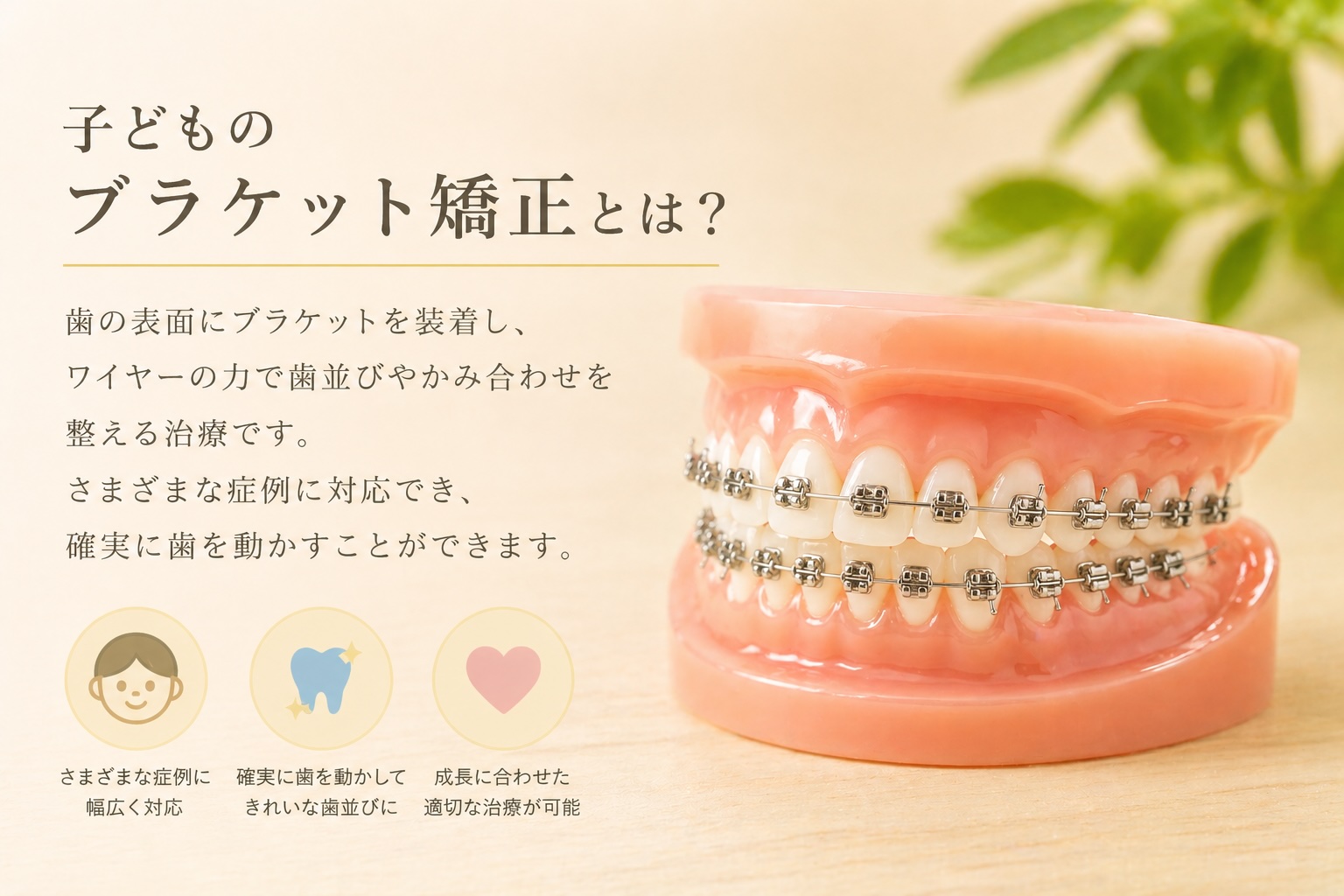 ブラケット矯正